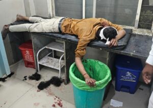 नशेड़ी ने सिगरेट के पेसो को लेकर दराते से किये हमले में तीन लोग घायल,नागरिको ने पकड़ा,4 घायल, 2 को सीहोर किया रेफर